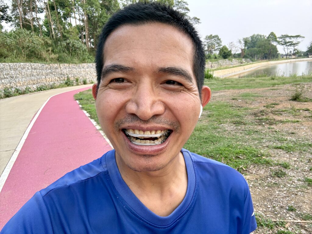 ความทุกข์ทรมานของการจัดฟัน